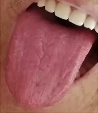 20190416