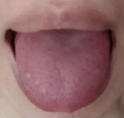 20190416