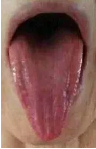 20190416